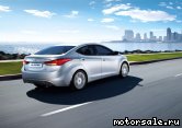  3:  Hyundai Elantra V (MD, UD)