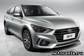  1: Hyundai Celesta